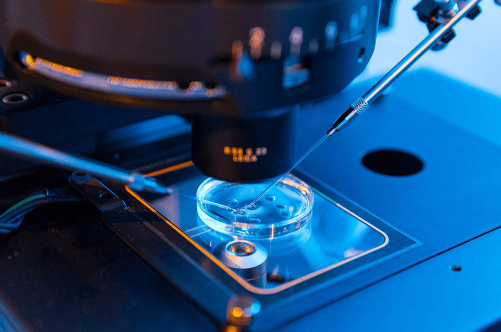 Fertilização In Vitro (FIV) com Injeção Intracitoplasmática (ICSI)