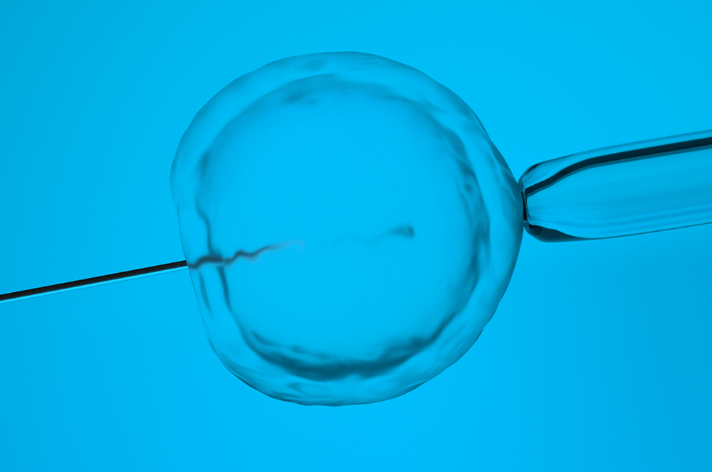 História da Fertilização In Vitro (FIV)