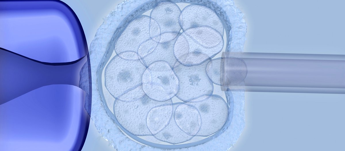 Teste Genético Pré-Implantacional (PGT)